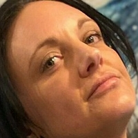 amputeedarling Naken