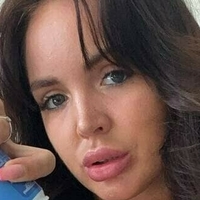 ccherrylipsx Naken
