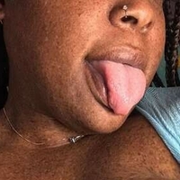 freckledfantasy5 Naken