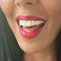 rachelstarrxxx Naken