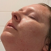 titlaser Naken