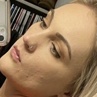 xoxalexis Naken